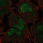 CHP2 Polyclonal Antibody