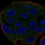 UGT1A6 Polyclonal Antibody