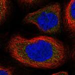 SLK Antibody in Immunocytochemistry (ICC/IF)
