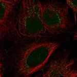 TIGD6 Antibody in Immunocytochemistry (ICC/IF)