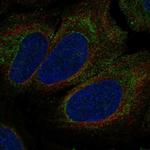 P2X1 Polyclonal Antibody