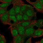 LRRC31 Antibody in Immunocytochemistry (ICC/IF)