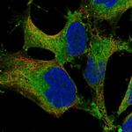 SH3PXD2B Polyclonal Antibody