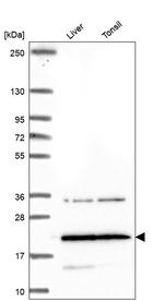 TM4SF18 Antibody in Western Blot (WB)