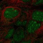 STPG2 Polyclonal Antibody