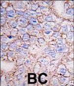 MAPK15 Polyclonal Antibody