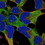 FNDC8 Polyclonal Antibody