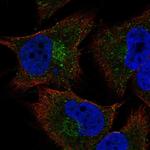 COL20A1 Polyclonal Antibody