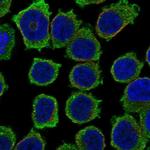 ITK Polyclonal Antibody