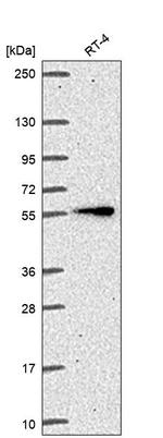 ITK Antibody in Western Blot (WB)