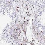 TMEM54 Polyclonal Antibody