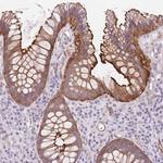 DIXDC1 Polyclonal Antibody