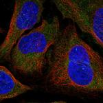 DLC1 Polyclonal Antibody