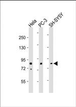 DYRK1A Antibody in Western Blot (WB)