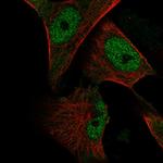 CREB3L1 Polyclonal Antibody