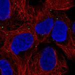 PRDX3 Polyclonal Antibody