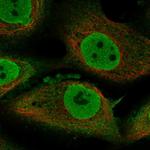 TENM1 Polyclonal Antibody