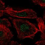 Histone H3.3B Polyclonal Antibody