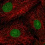 POP4 Polyclonal Antibody