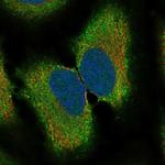 RAB41 Polyclonal Antibody