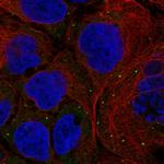 Fancd2os Antibody in Immunocytochemistry (ICC/IF)