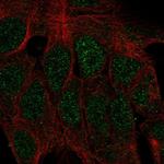 ATOH1 Polyclonal Antibody