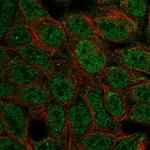 ATOH1 Polyclonal Antibody