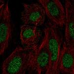 FN3KRP Polyclonal Antibody