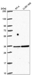 FN3KRP Antibody in Western Blot (WB)