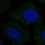 SLC30A8 Antibody in Immunocytochemistry (ICC/IF)