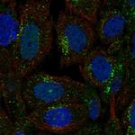 SEC23A Polyclonal Antibody