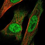 IRX3 Polyclonal Antibody