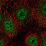 TEX49 Polyclonal Antibody