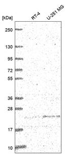 ULBP2 Antibody in Western Blot (WB)