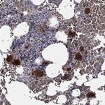 CTSW Polyclonal Antibody