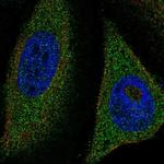 TFEB Polyclonal Antibody