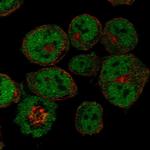 CITED2 Polyclonal Antibody