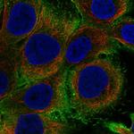 IL1F9 Polyclonal Antibody