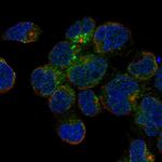 CD1c Polyclonal Antibody