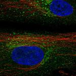 TIMP3 Polyclonal Antibody