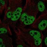 Estrogen Receptor beta Polyclonal Antibody