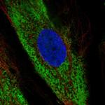 COL1A2 Polyclonal Antibody