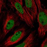 USF1 Polyclonal Antibody