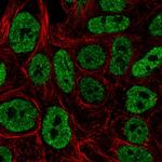 JNK3 Polyclonal Antibody