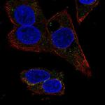 SERPINA4 Polyclonal Antibody