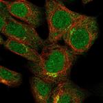 STH Polyclonal Antibody