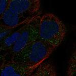 GDF7 Polyclonal Antibody