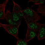 ADPRM Polyclonal Antibody