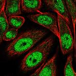 PRDM13 Polyclonal Antibody