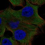 PK2L1 Polyclonal Antibody